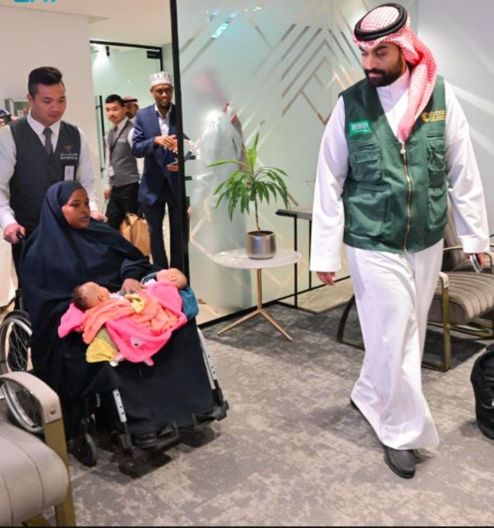 صور| التوأم الملتصق الصومالي "رحمة ورملا" يصلان الرياض لدراسة حالتهما
