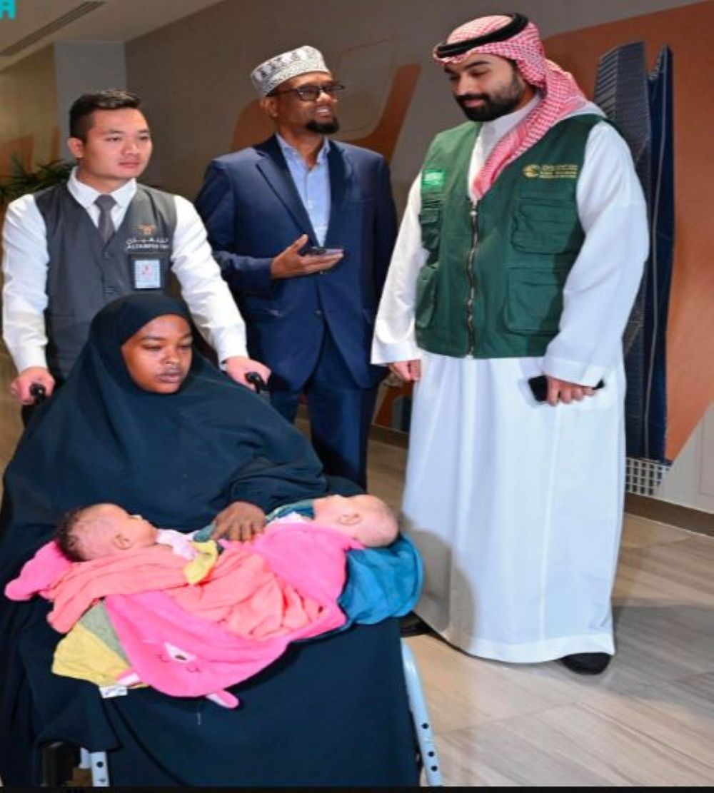 صور| التوأم الملتصق الصومالي "رحمة ورملا" يصلان الرياض لدراسة حالتهما