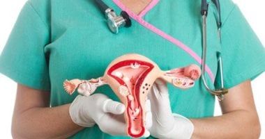 للنساء.. تغييرات بسيطة تقلل خطر الإصابة بسرطان المبيض