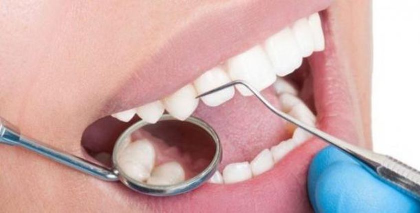 صحة فمك مرآة لقلبك.. رابط خفي بين اللثة والأوعية الدموية