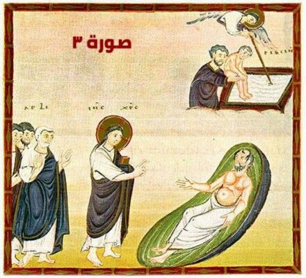 تخلُّع وقيامة وشفاء