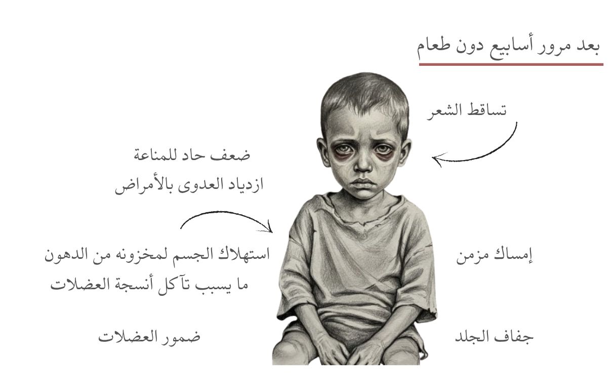 250% زيادة في "تصنيف الخطر".. هكذا يموت سكان غزة جوعًا