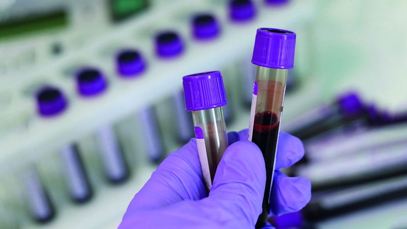 الامارات | فحص روتيني ينقذ حياة طيّار.. وآخر ينجو من جلطة مصادفة
