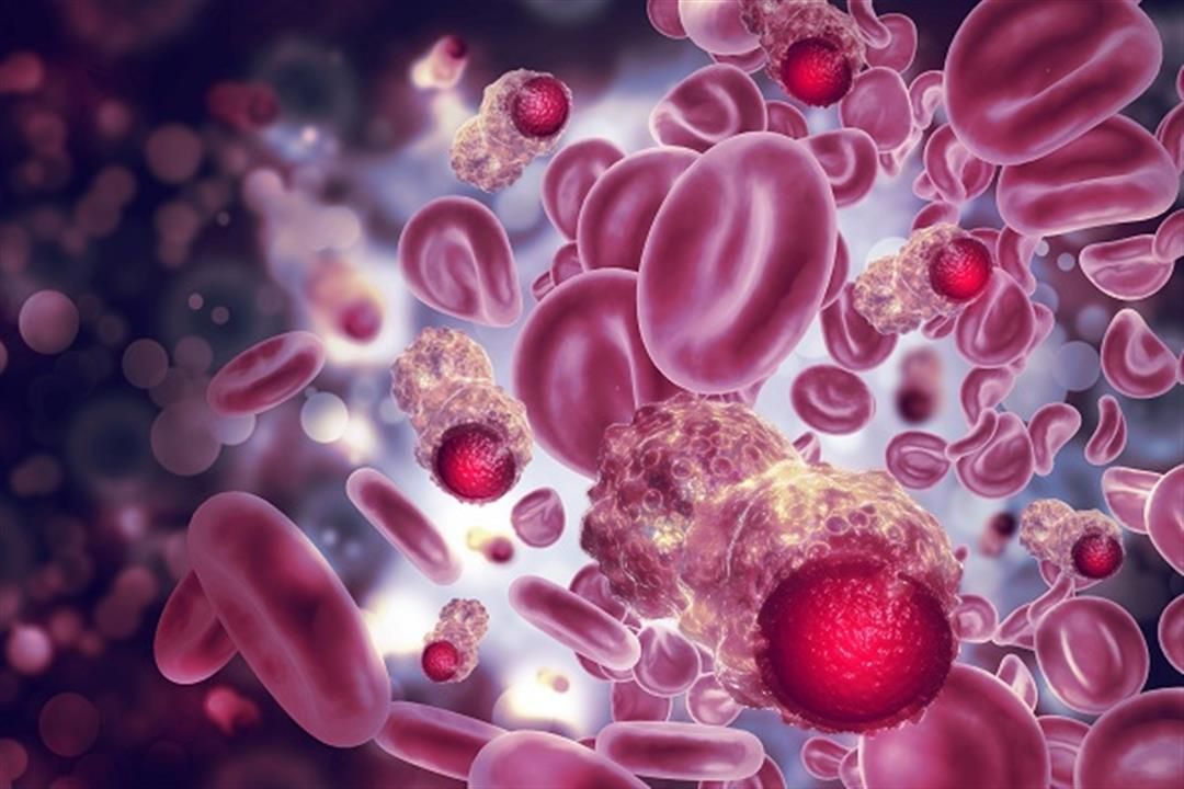 "مش مجرد تعب".. 7 أعراض خفية قد تكون جرس إنذار لسرطان الدم