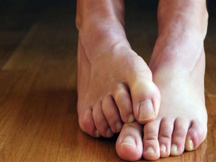 ما أسباب وعلامات متلازمة تململ الساقين؟