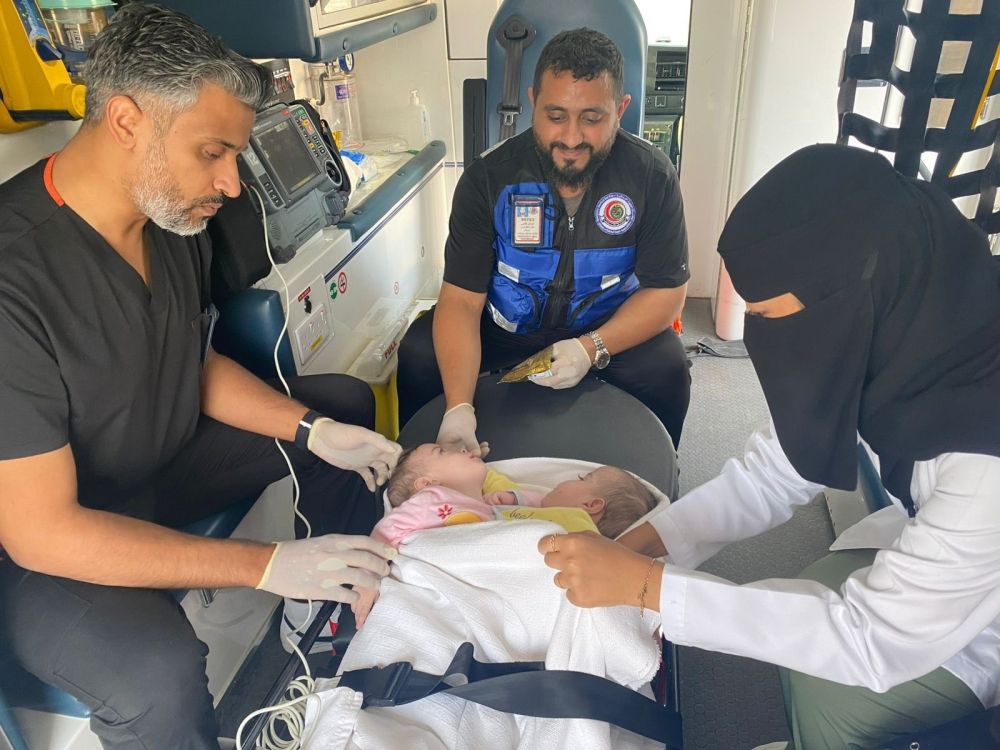 الأحد المقبل موعد جراحة فصل التوأمين السوريين (سيلين وإيلين)