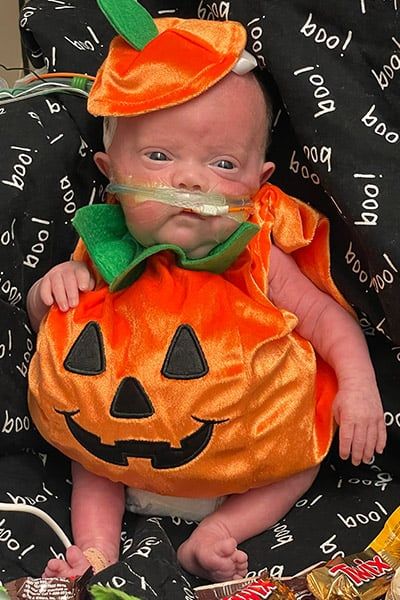 nash-keen-most-premature-baby-dressed-as-pumpkin-for-first-halloween-aged-three-months nash-keen-most-premature-baby-dressed-as-pumpkin-for-first-halloween-aged-three-months