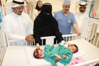 عملية فصل التوأم يارا ولارا تدخل مرحلتها الخامسة