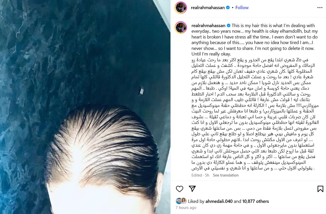 إصابة جديدة تتعرض لها رحمة حسن بعد سقوط شعرها.. أعرفوا تفاصيلها