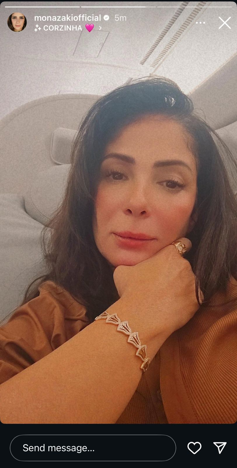 منى زكي تتألق في أحدث ظهور بلوك كاجوال .. صور